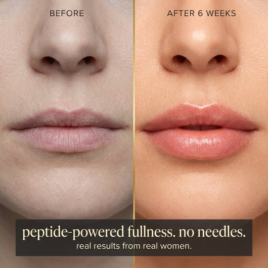 Bitten Petal™ Peptide Lip Serum